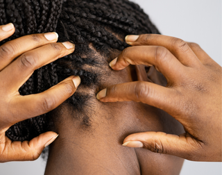 4 Ways to Take Care of Your Scalp During Winter